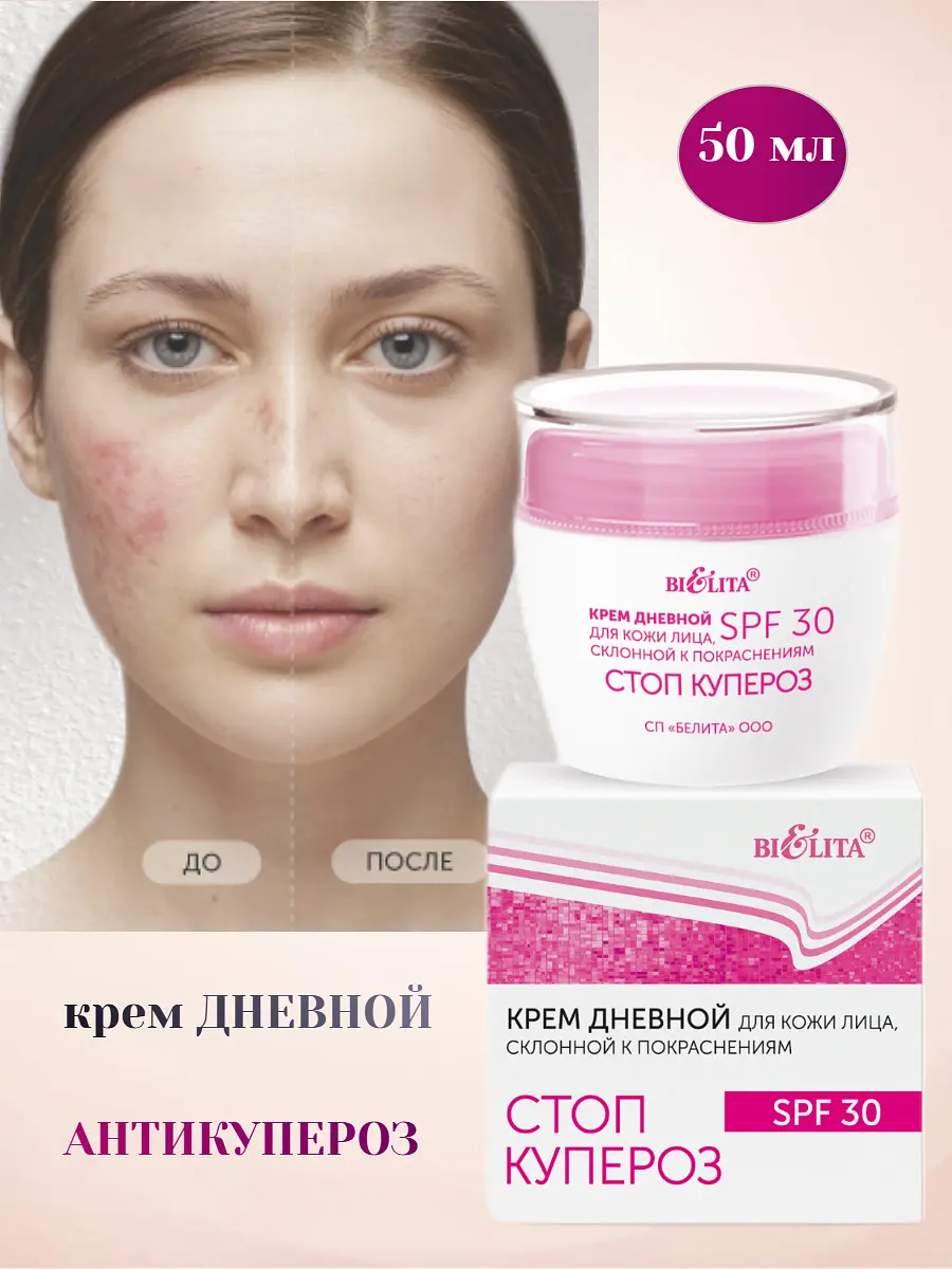 Крем Белита Стоп купероз дневной SPF30 50 мл дневной SPF30 50 мл для чувствительной кожи