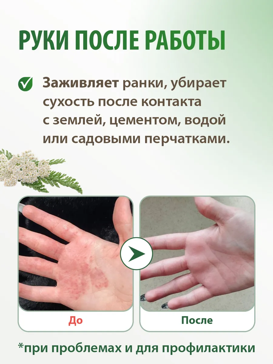 Крем Акрустал Пихтовая Формула 65 мл для ухода за сухой и пораженной кожей (при зуде, шелушении, способствует заживлению трещин) Акрустал НПК ООО